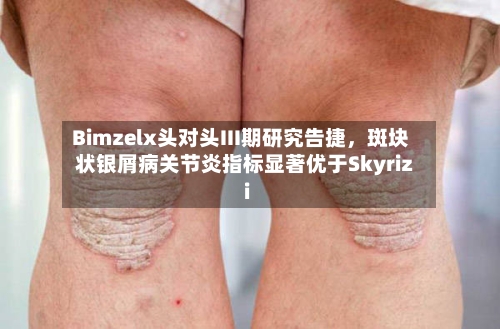 Bimzelx头对头III期研究告捷，斑块状银屑病关节炎指标显著优于Skyrizi-第3张图片